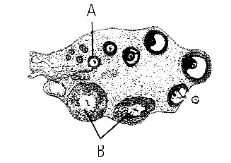 NEET 2013 (Karnataka) Biology - Human Reproduction Question 44 English